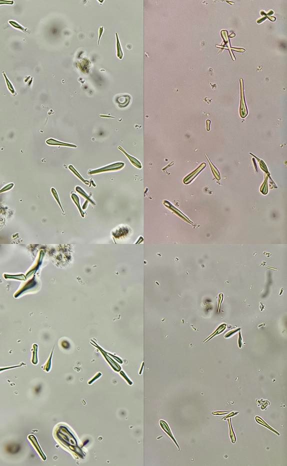 CEFTRIAXONA