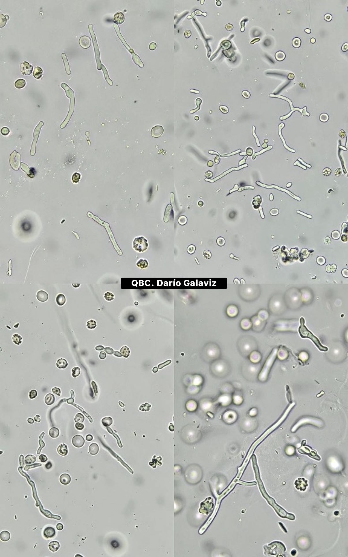 FUNGURIA