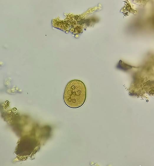 Entamoeba coli