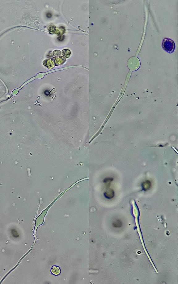 FORMAS "L" BACTERIANAS