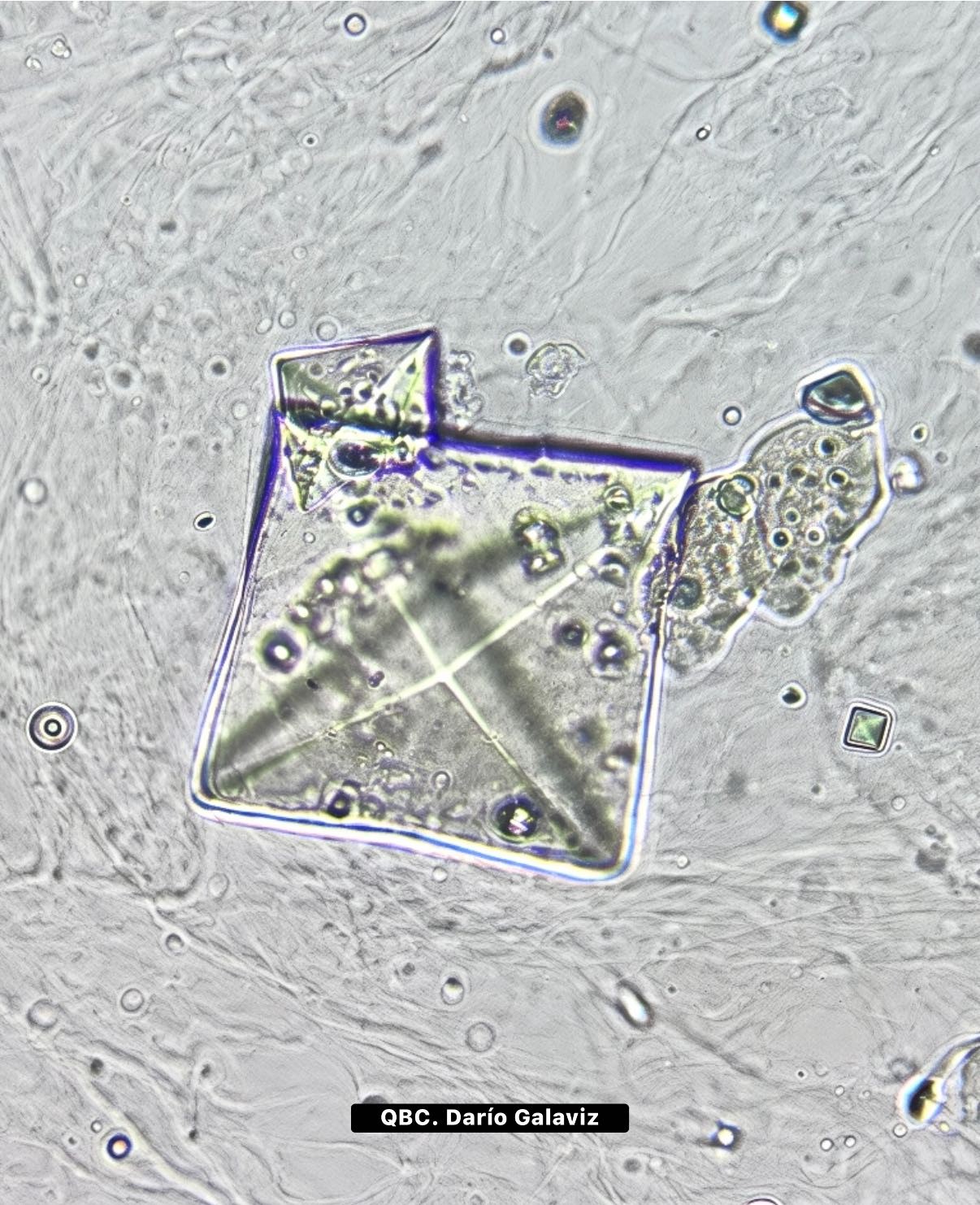 OXALATO DE CALCIO