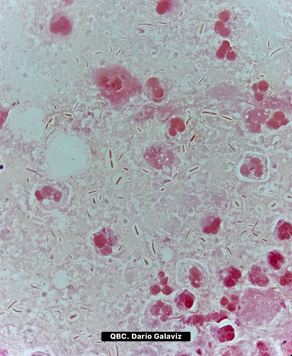 BACTERIAS ENCAPSULADAS