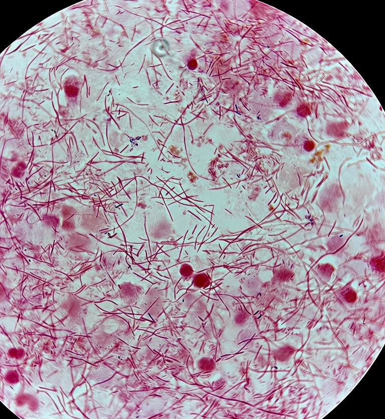 FILAMENTACION BACTERIANA