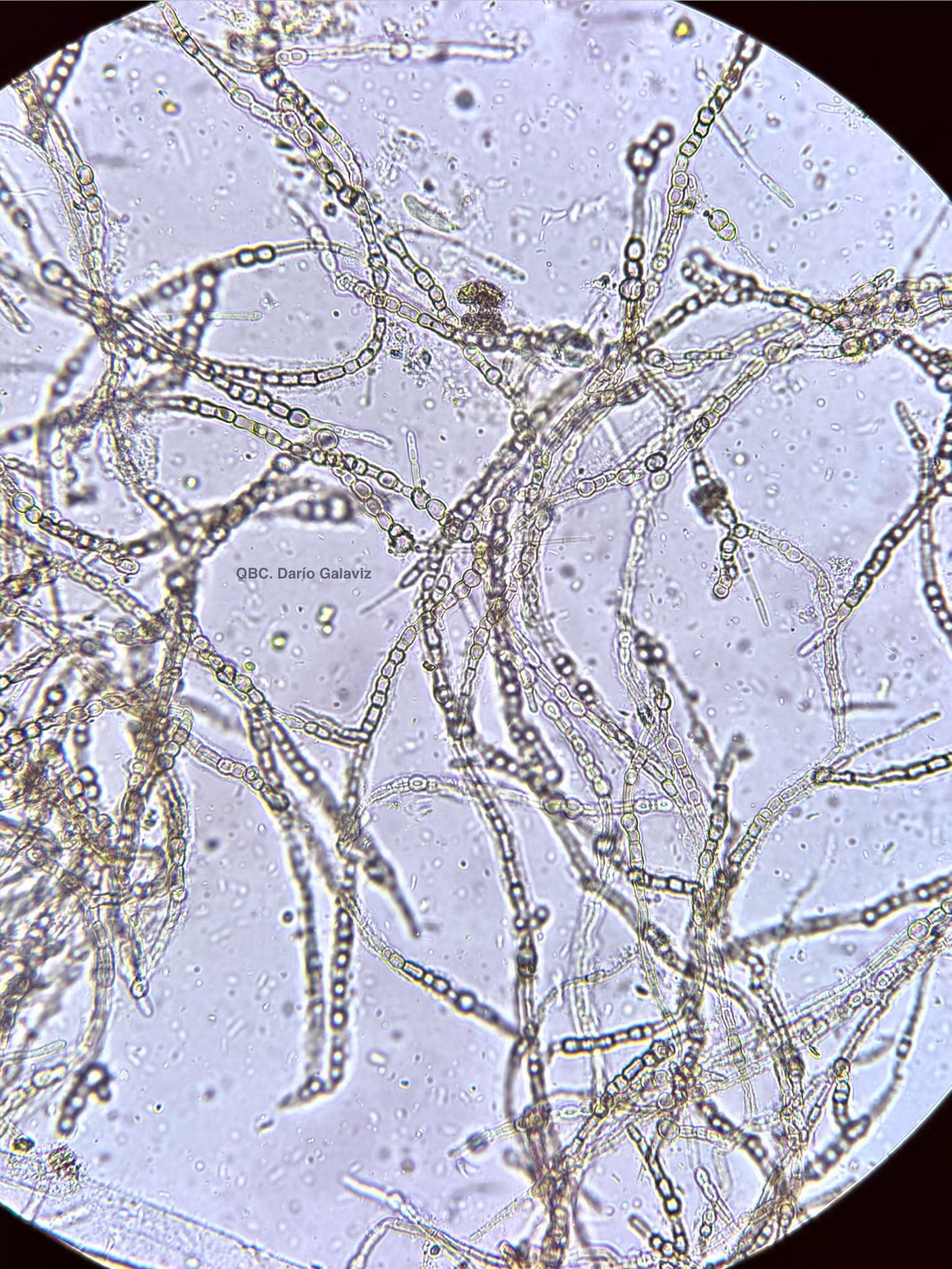 GASTROENTERITIS